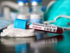 У Харкові зафіксовано близько 1,1 тисячі випадків захворювання на коронавірус